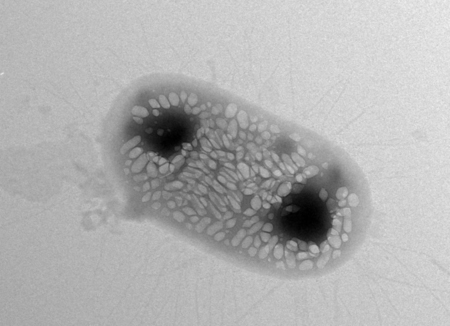 e coli with gas vesicles