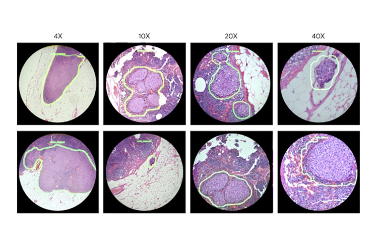 google ar microscope cancer featured website