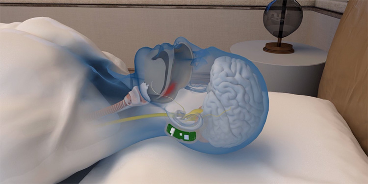 snore circle image