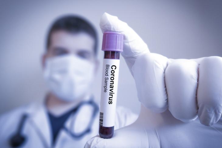 Coronavirus blood sample shutterstock website