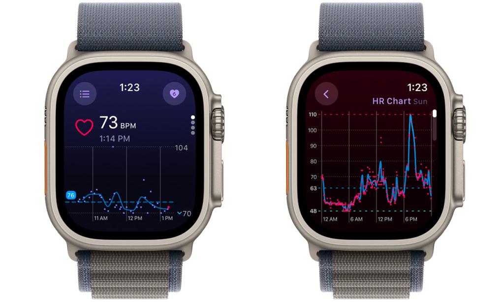 Heart Analyzer app on Apple Watch showing heart rate graphs