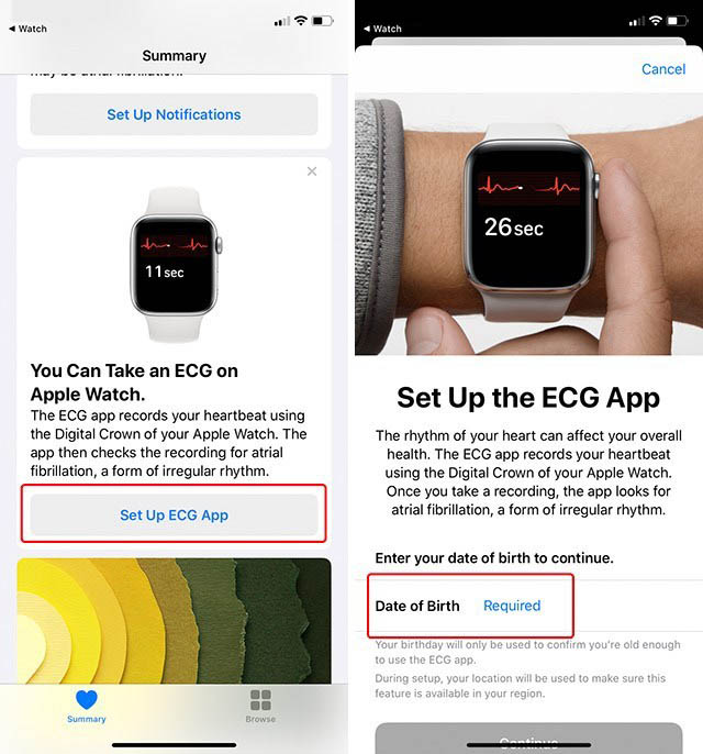 Apple watch best sale ecg region