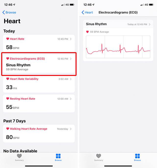 Apple watch ecg discount report