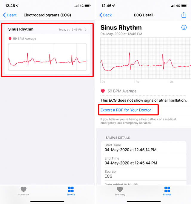 How to Use Apple Watch ECG Feature Effectively