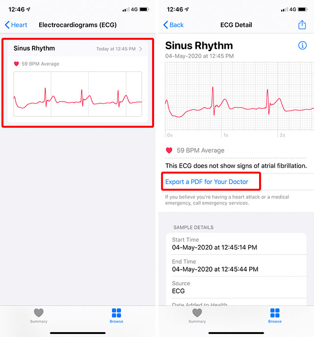 Ekg on discount my apple watch