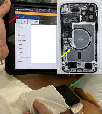 Apple warns users to keep their iPhone 12 away from pacemakers 