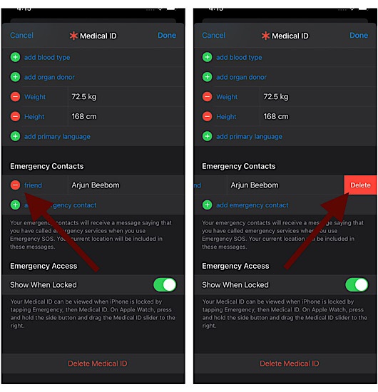 Remove emergency contact from iPhone and Apple Watch