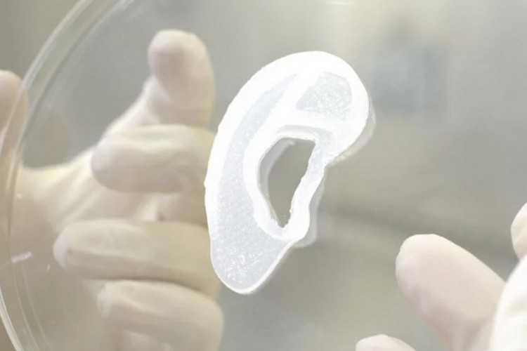 20-Year-Old Girl Becomes the First Person to Get a Functional 3D Printed Ear Made of Her Own Tissue!