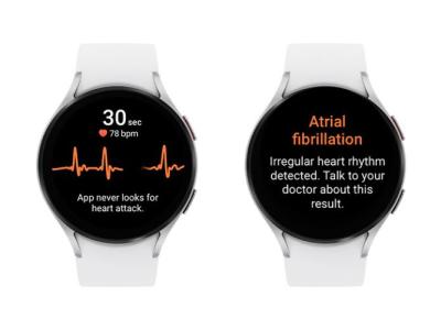 Samsung gains FDA approval for irregular heart rate monitoring