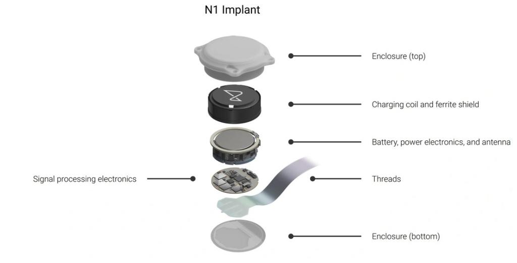 neuralink brain chip implant